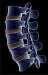 The lumbar vertebrae