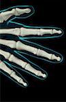 The bones of the fingers