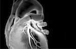 The coronary vessels of the heart