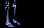 The bones of the leg