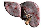 Gall bladder and liver