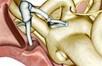 Auditory ossicles