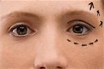 Gros plan d'une jeune femme avec marquage préopératoire sur son visage