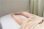 Legs of a woman receiving acupuncture treatment