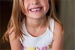 Girl With Missing Tooth