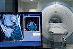 MRI scanner résultat sur l'écran d'ordinateur