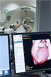 Cœur du patient CT-scan résultat montré sur le moniteur