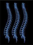 3d x-ray illustration of three human spines