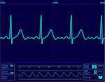 heart monitor screen with normal beat signal