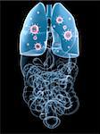 3d rendered anatomy illustration of human organs with lung infection