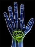 3d rendered x-ray illustration of a hand with highlighted joint