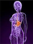 3d rendered illustration of a transparent female body with tumor in stomach