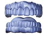 3d image of mesh denture isolated in white