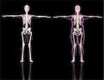 3D renders of two female skeletons one slim and one overweight