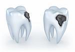 Teeth with caries, 3D image. White background