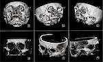 MRI of human head on black and white film