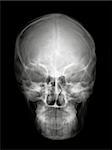 Human head on black and white x-ray film