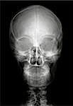 Human head on black and white x-ray film