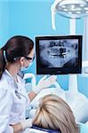 Dentist shows a patient x-ray