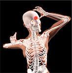 3D render of a female medical skeleton with migraine