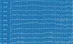 Brain wave electroencephalogramme (EEG)
