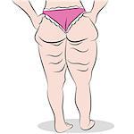An image of a woman with cellulite on her thighs.