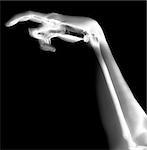 An computer created image of an x-rayed hand.