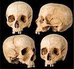 Human Skull in four angles on black background
