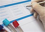 Doctor ticking box on a blood test from