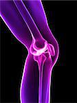 3d rendered x-ray illustration of a human painful knee