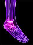 3d rendered x-ray illustration of a human painful foot