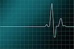 Health control concept. Heart cardiogram . Cardiogram  board.