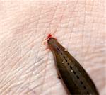 Leech sucking blood from a leg at tropical rainforest, Malaysia.
