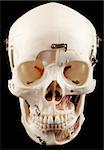 real human skull modified for medical education