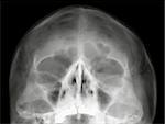 Human head from below on black and white x-ray film