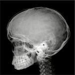 Side view of Human head on x-ray film