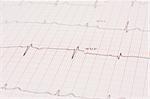 Detail of an electrocardiogram, heart analysis