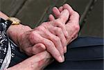 Extreme sceriosis on the hands of an elderly female.