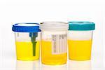 Fresh urine samples in plastic medical containers.