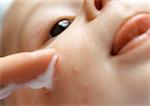 Baby-Lotion auf Pipmles Gesicht, extreme Nahaufnahme angewendet haben