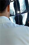 Rear view of a male doctor examining an X-Ray report