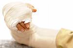 broken arm bone in a cast and bandages over white background isolated