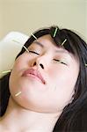 Asian woman with acupuncture needles in her face, eyes closed
