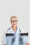 Porträt des weiblichen Oberarzt mit Röntgen über den grauen Hintergrund