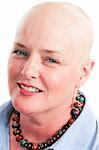 Closeup portrait of beautiful cancer survivor who has lost her hair due to chemotherapy.