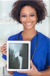 An African American female woman medical doctor in hospital holding a tablet computer with a hip replacement patient X-ray on the screen