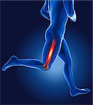 3D running medical man with thigh bone highlighted