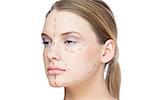 Pretty blonde woman with dotted lines on the face before surgery