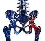 3D illustration of a human glass skeleton hip in pain. Isolated over white background.