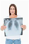 Portrait of a serious young woman holding lung x-ray over white background